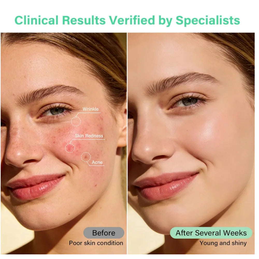 Red Light Therapy Facial Beauty Device