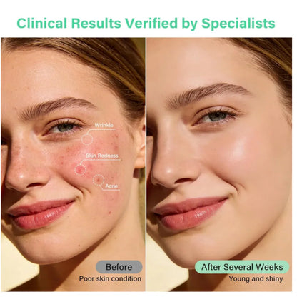 Red Light Therapy Facial Beauty Device